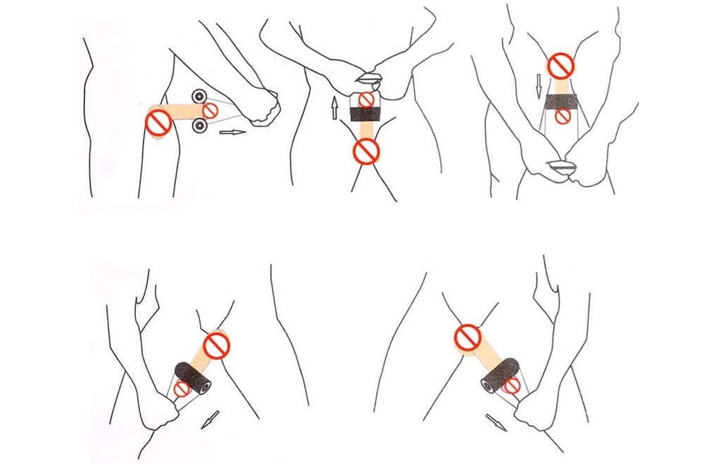 jelqing用于阴茎增大